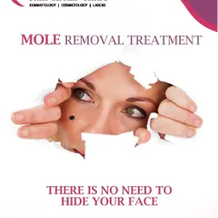 Moles can be a cosmetic concern for many individuals. I perform mole removal using advanced techniques like CO₂ laser to ensure the procedure is safe, effective, and leaves behind minimal marking for a natural-looking result.