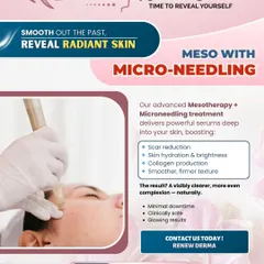 This graphic explains our Meso with Microneedling treatment. This procedure uses fine needles to create micro-channels in the skin, allowing powerful mesotherapy serums to penetrate deeply for enhanced scar reduction, hydration, and collagen production.
