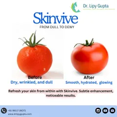 This before and after shows the transformation from dry and dull to smooth and hydrated skin, similar to a tomato regaining its plumpness. This is what Skinvive injectable moisturizer does for your skin from within.