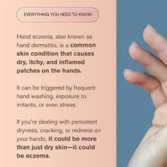 Also known as hand dermatitis, hand eczema is a common condition that causes inflammation and irritation. It can be triggered by frequent hand washing, stress, or exposure to certain substances.