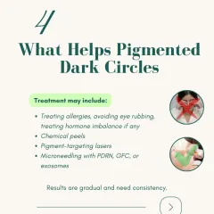 What helps pigmented dark circles? Treatment may include a combination of approaches, from addressing underlying allergies to in-clinic procedures like chemical peels, pigment-targeting lasers, or microneedling with PDRN. Results are gradual and require consistency.