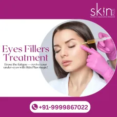 Revive tired-looking eyes with our under-eye filler treatment. This procedure is designed to erase fatigue by restoring volume to hollow areas, effectively reducing the appearance of dark circles for a brighter, more rested look.