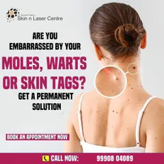 If you are embarrassed by moles, warts, or skin tags, there is a permanent solution. I offer safe and effective removal treatments at my clinic to help you achieve clear, smooth skin.