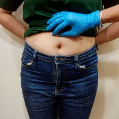 A full view of a new navel piercing on a client. I take care to ensure the placement is centered and looks balanced with your body.