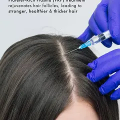 For women experiencing hair thinning or a widening parting, PRP treatment offers a targeted solution. I perform precise injections of platelet-rich plasma into the scalp to rejuvenate follicles, improve hair strength, and promote new, healthy growth.