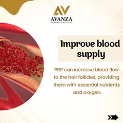 One of the key benefits of PRP therapy is improved blood supply. By increasing blood flow to the hair follicles, we ensure they receive the essential nutrients and oxygen needed for robust growth.