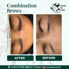 This before-and-after shows how Combination Brows can create structure and fullness. The mix of microblading and shading gives a polished look that still appears natural.