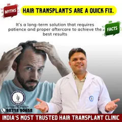 **Myth:** Hair transplants are a quick fix. **Fact:** It is a permanent solution, but it requires patience and proper aftercare. The full results develop over 9 to 12 months.