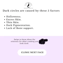 Dark circles are caused by 5 main factors: hollowness, excess skin, thin skin, dark pigmentation, and lack of bone support. We diagnose the specific cause to find the right solution for you.