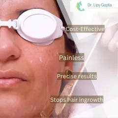 This image highlights the key benefits of facial laser hair reduction. The procedure is cost-effective in the long run, virtually painless, delivers precise results by targeting only the hair follicle, and is an excellent solution for preventing ingrown hairs.
