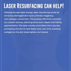 Laser resurfacing works by using focused light energy to remove damaged skin layers, which in turn triggers new collagen production. This process effectively smooths uneven texture, reduces the depth of acne scars, and fades pigmentation for tighter, clearer skin.