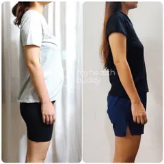 A side view showing the results of our DR correction program. The client's core is visibly flatter and stronger, a result of consistent and correct exercise.