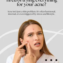 This graphic addresses the frustration of dealing with persistent acne. It highlights that acne is often an internal issue, which is why our approach involves a thorough diagnosis to find the true trigger.