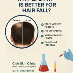 For more advanced hair fall, we offer GFC (Growth Factor Concentrate) therapy. This infographic explains how GFC delivers more growth factors than standard PRP, leading to faster, more visible results with no downtime.