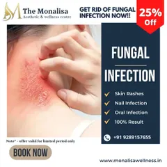 We offer effective medical treatments for fungal infections affecting the skin and nails. Our approach ensures you get a proper diagnosis and a plan that delivers results.