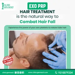 EXO PRP is an advanced form of PRP that uses exosomes to enhance the regenerative process. This graphic explains how we use the power of your own platelets to combat hair fall naturally, a method I have trusted and perfected over 20 years.