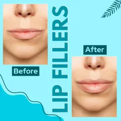 See the subtle yet impactful transformation possible with our lip fillers. We focus on creating natural-looking volume and definition, enhancing your features while maintaining facial harmony.