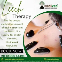 Leech therapy, or Raktamokshana, is a unique and powerful Ayurvedic method for blood purification. It is highly effective for stubborn skin diseases, baldness, and other conditions caused by impure blood.