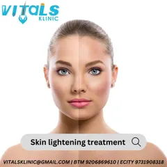 For those seeking a lighter and more even skin tone, we provide professional and safe skin lightening treatments. Our team uses clinically approved methods to address complexion concerns for both men and women.