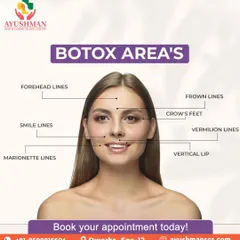 This diagram shows the common areas we treat with Botox. From forehead lines and crow's feet to smile lines, we use precise techniques to achieve a smoother, more refreshed look while maintaining natural expression.