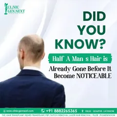 Did you know? A man often loses half of his hair before the baldness becomes noticeable to others. This is why early consultation is so important.