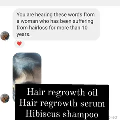 This is the same powerful feedback from a customer who struggled with hair loss for a decade. Seeing her share a picture of her progress means the world to me.