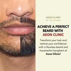 Achieve the perfect beard with our transplant services. We can transform a patchy beard into a full, flawless look, restoring your confidence.