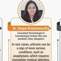 Urticaria, or hives, can be acute or chronic and is caused by histamine release in the skin. While often triggered by allergens, chronic cases can be complex. It is important to get a proper diagnosis, as in rare cases it can signal a more serious condition.