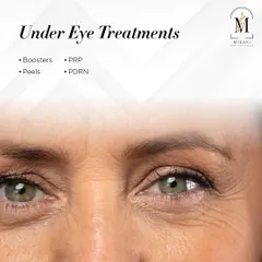 I offer a range of treatments to rejuvenate the delicate under-eye area. This graphic lists some of the options, including boosters, PRP, peels, and PDRN, each designed to address specific concerns like dark circles or fine lines.