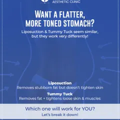 Many patients ask about the difference between a tummy tuck and liposuction. Liposuction is excellent for removing stubborn fat if your skin is firm, while a tummy tuck is designed to remove excess skin and tighten separated abdominal muscles, often after pregnancy or weight loss.