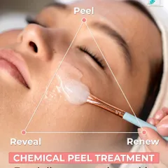 A chemical peel is a three-step process: peel, renew, and reveal. I customize the peel based on your skin type and concerns to ensure controlled exfoliation, revealing smoother texture and improved clarity without compromising your skin barrier.
