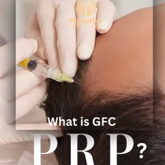 A close-up of the GFC PRP (Growth Factor Concentrate Platelet-Rich Plasma) treatment. This procedure uses your body's own concentrated growth factors, which I inject into the scalp to rejuvenate follicles, reduce hair fall, and stimulate new, stronger hair.