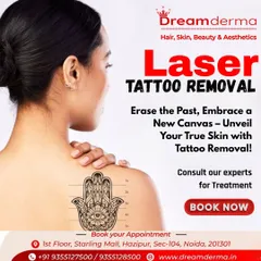 Ready for a new beginning? My laser tattoo removal service helps you erase unwanted ink and gives you a fresh canvas. It is a safe and effective way to reclaim your skin and embrace a new you.