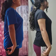 This side-profile comparison highlights Adyasha's incredible progress in posture and core strength. By focusing on functional exercises, we were able to achieve a flatter stomach and a more aligned, confident stance.