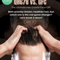 Wondering about the best non-surgical option for you? This guide breaks down two of my most popular treatments, QR678® and GFC, to help you understand which hair growth face-off is the right game-changer for your specific needs.