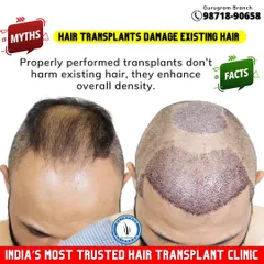 **Myth:** Hair transplants damage existing hair. **Fact:** When performed correctly by an experienced surgeon, the procedure does not harm existing hair. In fact, it is designed to enhance the overall density by adding hair to thinning areas.