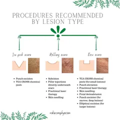 Acne scars require a tailored approach. This chart shows some of the advanced in-clinic procedures I use, such as TCA CROSS peels for ice pick scars and fractional laser for rolling scars, to achieve significant improvement in skin texture.