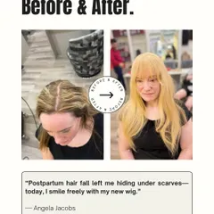 Postpartum hair fall is a difficult journey for many new mothers. Angela went from hiding under scarves to smiling freely again with her new, natural-looking blonde wig.