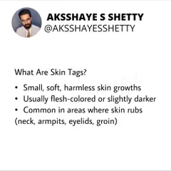 What are skin tags? They are small, soft, harmless skin growths that are common in areas where skin rubs, like the neck, armpits, and groin. They are often a sign of underlying insulin resistance.