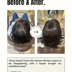 For Smita, losing hair in the shower felt like losing a piece of herself. A custom-blended topper gave her back that feeling of fullness and helped her stop worrying about hair fall.