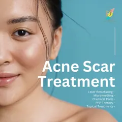Treating acne scars is not a one-size-fits-all process. I offer a range of effective treatments including Laser Resurfacing, Microneedling, Chemical Peels, and PRP Therapy. The right combination is selected after a thorough analysis of your scar type and skin condition.