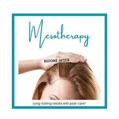 This graphic highlights the before-and-after results of Mesotherapy for hair, showing a fuller and healthier hairline.