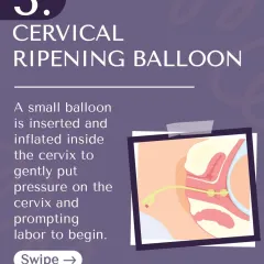 Method 3: A cervical ripening balloon. A small balloon is inflated inside the cervix to gently put pressure on it and prompt labor to begin.