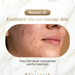 Reason 1: Undiluted Oils Can Damage Skin. A visual showing the potential for painful reactions and skin damage from applying potent, undiluted essential oils directly to the face.