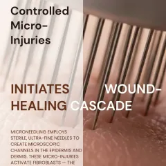 The microneedling process employs sterile, ultra-fine needles to create microscopic channels in the skin. These controlled micro-injuries initiate a wound-healing cascade, activating the fibroblast cells responsible for skin repair and collagen production.
