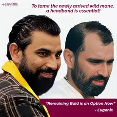 "Remaining bald is an option now." This powerful statement from a happy patient captures the essence of our work. We provide a choice and a path to regain the look you desire.