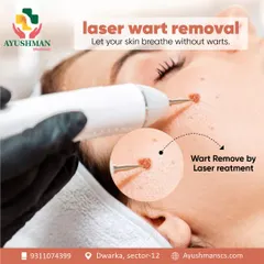 Let your skin breathe without warts. This image shows the precision of my laser wart removal treatment, which effectively targets and removes warts for clear, smooth skin.