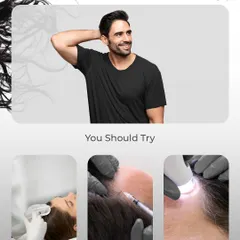 If you want to achieve healthier, fuller hair, there are several non-surgical options to consider. We offer treatments like scalp peels to improve scalp health, hair booster injections (PRP/GFC) to stimulate growth, and microneedling to enhance follicle function.