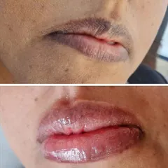This is a great example of dark lip correction, one of my specialized services. The client had significant hyperpigmentation, which I carefully neutralized before applying a warm, rosy tint. The final look is bright, even-toned, and completely natural.