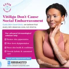 Vitiligo should not cause social embarrassment, as we believe every skin deserves care, not shame. Our advanced dermatological solutions help restore skin pigmentation, slow down depigmentation, and provide holistic, customized care.